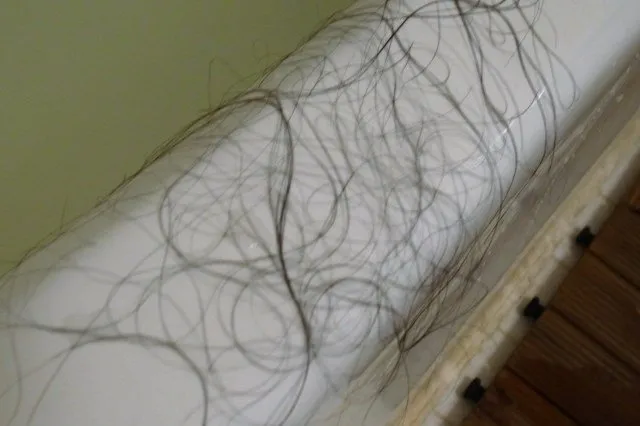 baldness-sign